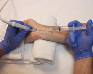 Deep Tissue Peripheral Nerve Block