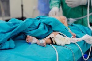 total intravenous anesthesia (TIVA) in pediatric patients