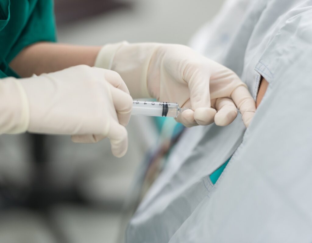 Spinal and Epidural Anesthesia