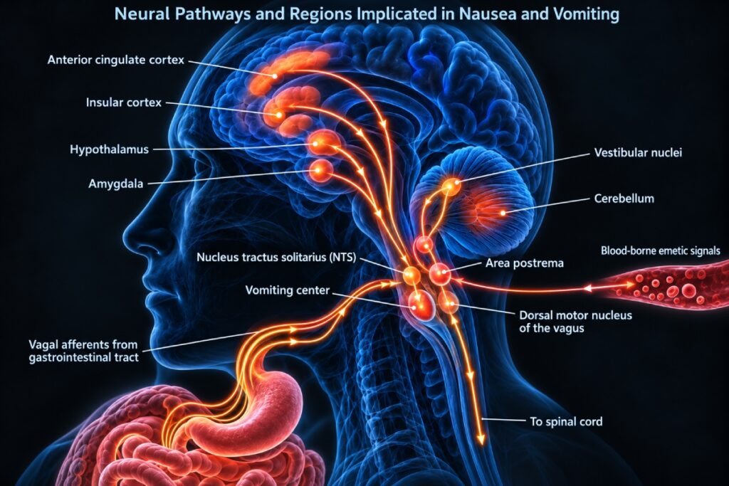 anesthesia-induced nausea